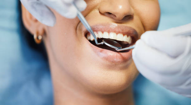 Best Chipped Tooth Repair Near Me  in Caledonia, MI