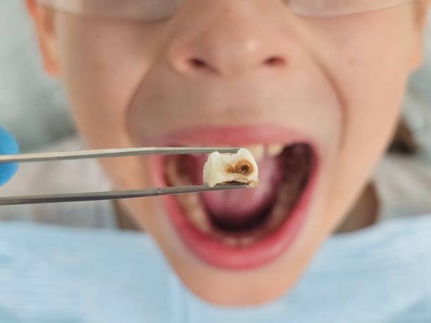 Best Tooth Infection Emergency Dentist  in Caledonia, MI